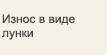 Износ в виде лунки