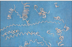 Cavacos formados pelo inserto com quebra-cavacos